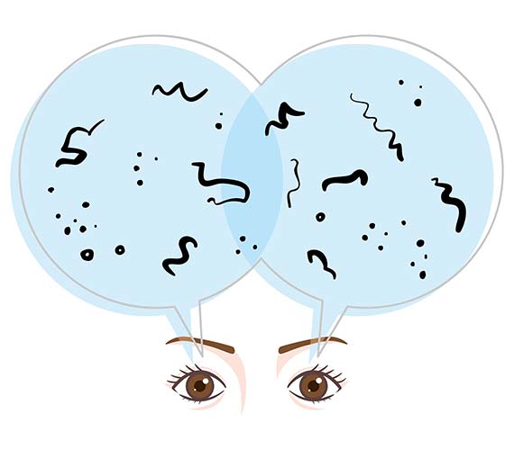 飛蚊症・網膜はく離